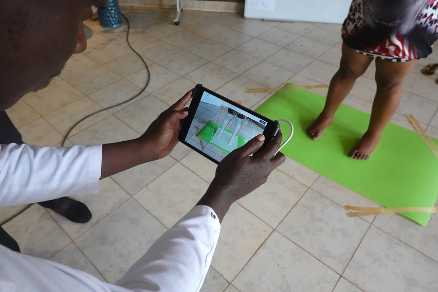 Scan images of affected body parts provide an initial indication of whether patients suffer from podoconiosis and can participate in the clinical trial within the TAKeOFF research network. Scan images of affected body parts provide an initial indication of whether patients suffer from podoconiosis and can participate in the clinical trial within the TAKeOFF research network.